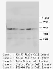 PPARG / PPAR Gamma Antibody (N-Terminus)