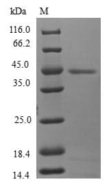 Human MTFP1 Protein (Recombinant GST, N-terminus)