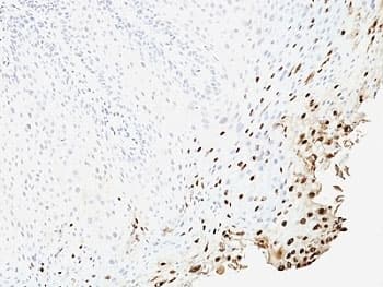 FAM49B / L1 Antibody (clone SPM257)