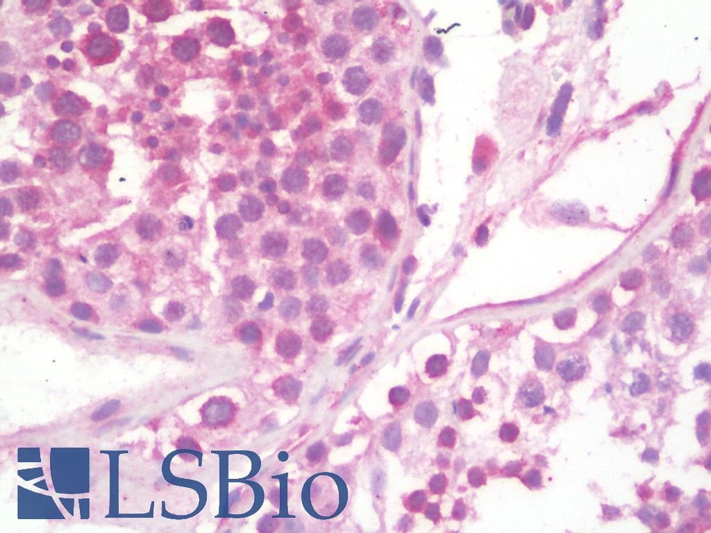 IHC-plus™ KANK2 Antibody