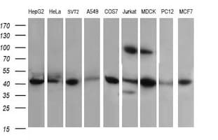 ACAA2 Antibody (clone OTI1B1)