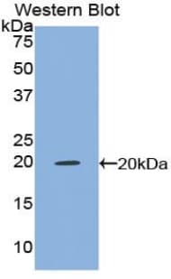 TNF Alpha Antibody (aa63-233, Cy3)