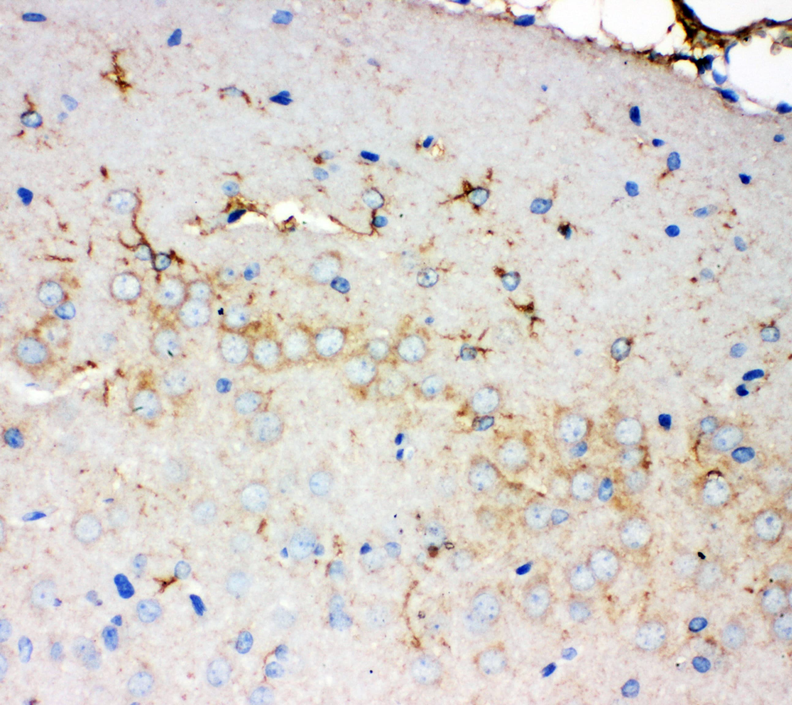 PMP70 Antibody (aa646-659)