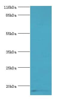 IHC-plus™ CALML5 Antibody (aa2-146)