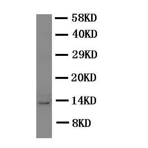 TFF1 / pS2 Antibody (aa59-72)