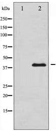 PRKAB1 / AMPK Beta 1 Antibody
