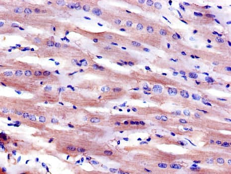 MSR1 / CD204 Antibody