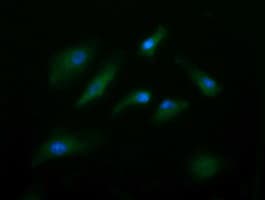 CD105 Antibody (clone OTI3D5, Carrier-free)