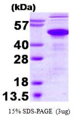 Human ATXN3 / JOS Protein (Recombinant)