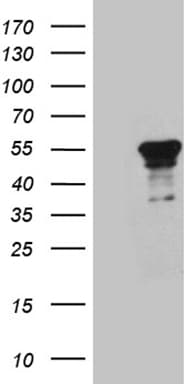MSY2 / YBX2 Antibody (clone OTI3B5)