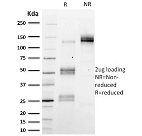 Monoclonal Mouse anti-Human EMD / Emerin Antibody (clone EMD/2167, Azide-free,BSA-free, IHC, WB)