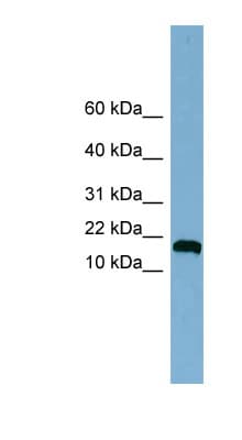 ANKRD37 Antibody (C-Terminus)