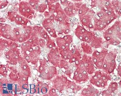 IHC-plus™ CARS1 / CARS Antibody