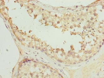 Polyclonal Rabbit anti-Human FAM113A Antibody (IHC)