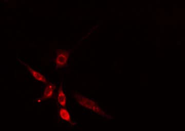 Polyclonal Rabbit anti-Human SLC30A9 / ZNT9 Antibody (IF, WB)