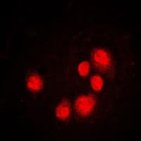 Polyclonal Rabbit anti-Human DDIT3 / CHOP Antibody (Internal, IHC, IF, WB)