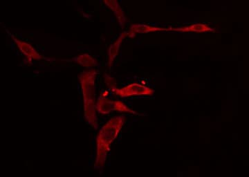 Polyclonal Rabbit anti-Human APOL1 / Apolipoprotein L Antibody (IF, WB)