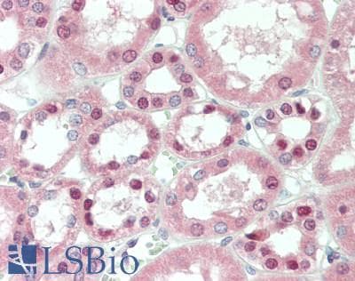 Polyclonal Rabbit anti-Human PKD3 / PRKD3 Antibody (aa352-384, IHC, IF, WB)