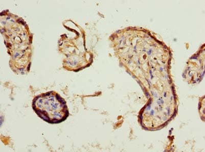Polyclonal Rabbit anti-Human COBLL1 Antibody (IHC)