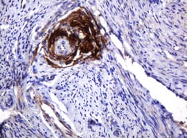 PARVB Antibody (clone OTI2H9)