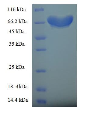 Human FZR1 Protein (Recombinant His-SUMO)