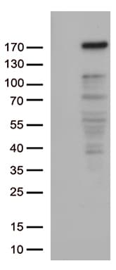 NEDD4 Antibody (aa160-460, clone OTI7A1)