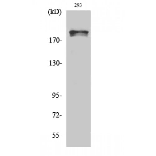 WNK1 Antibody (40-120 aa)