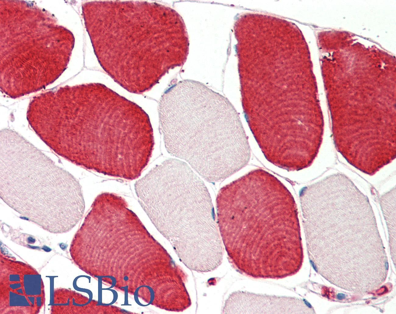 IHC-plus™ Polyclonal Goat anti-Human MIA / CD-RAP Antibody (aa28-40, IHC, WB)