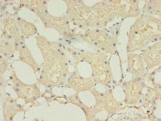 TMEM27 / Collectrin Antibody