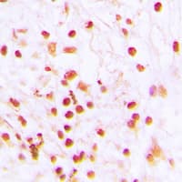 ERCC6 / CSB Antibody (N-Terminus)