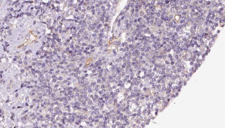 TIMM44 / TIM44 Antibody