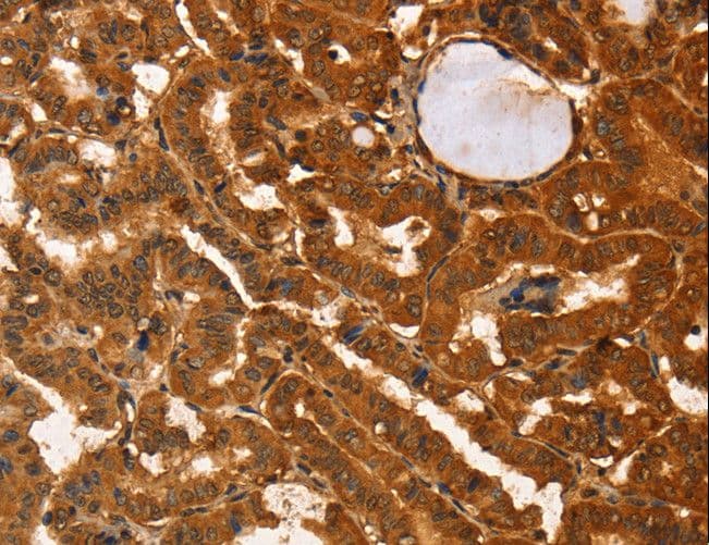 Polyclonal Rabbit anti-Human IKZF3 / AIOLOS Antibody (IHC)