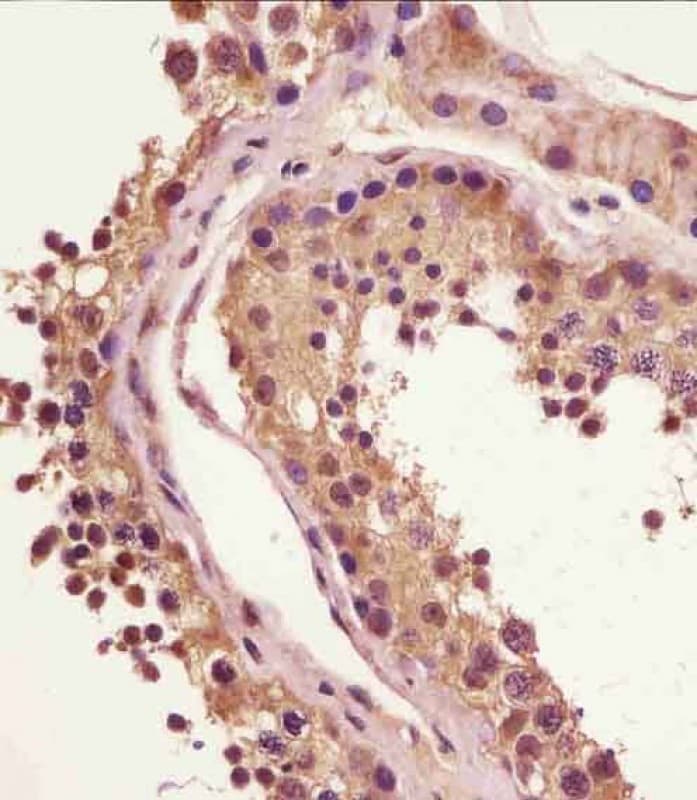 BRAF / B-Raf Antibody