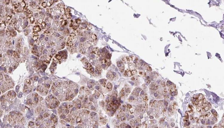 ETFDH Antibody