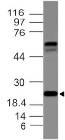 ILEI / FAM3C Antibody