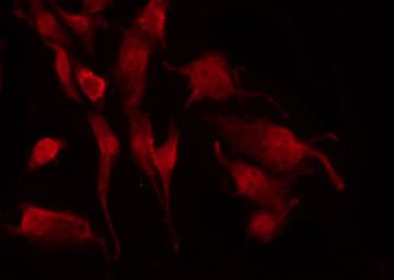 NGFR / CD271 / TNR16 Antibody