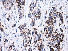 ATP5B / ATP Synthase Beta Antibody (clone OTI7F4)