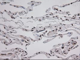 STAT3 Antibody (clone OTI21E7)