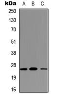 TREM1 Antibody (Internal)