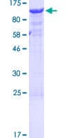 Human TRIP10 / CIP4 Protein (Recombinant GST)