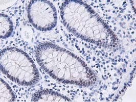 Dipeptidyl Peptidase 3 / DPP3 Antibody (clone OTI2D9)