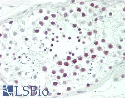 IHC-plus™ Polyclonal Rabbit anti-Human DDX1 Antibody (aa500-550, IHC, WB)