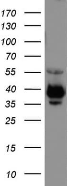 EPCAM Antibody (clone UMAB132)