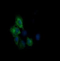 CTAG1B / NY-ESO-1 Antibody (clone OTI5A5)