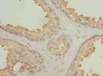 Polyclonal Rabbit anti-Human GLB1L2 Antibody (IHC)