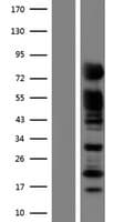 RAB11FIP5 / RIP11 Protein (Over-Expression Lysate Myc-DDK (Flag))
