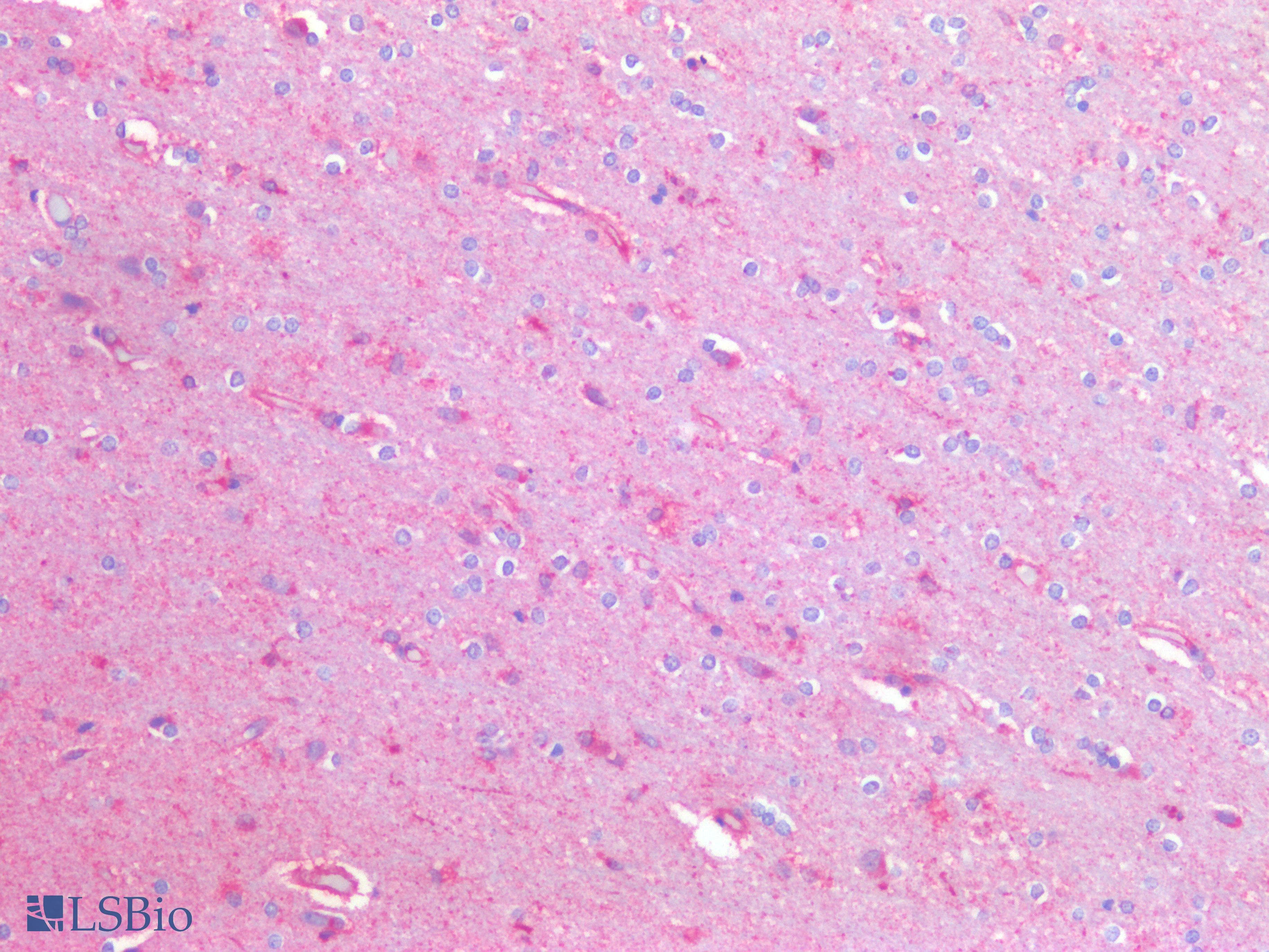 PathPlus™ HEXB Antibody