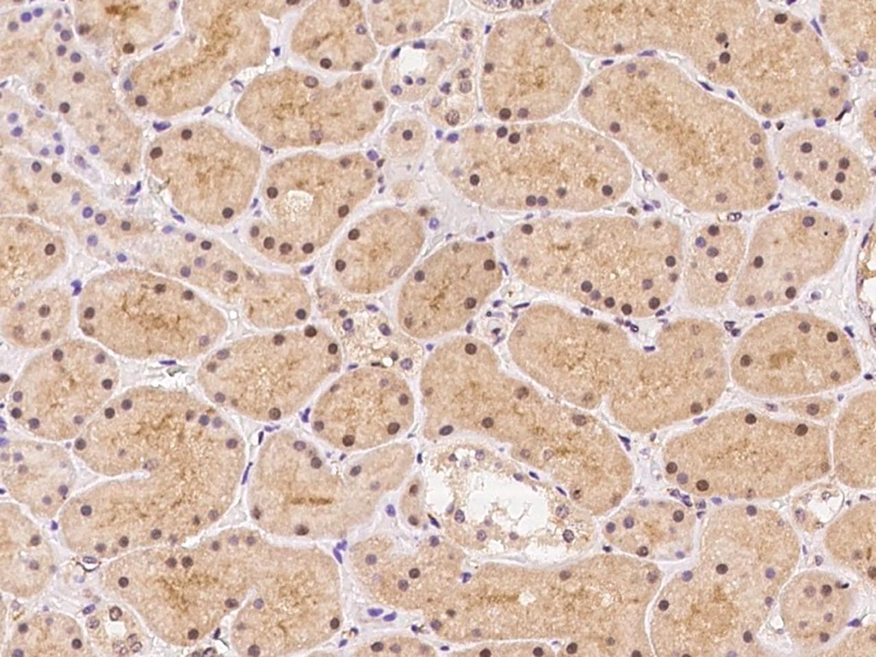 RASGRF1 / CDC25 Antibody