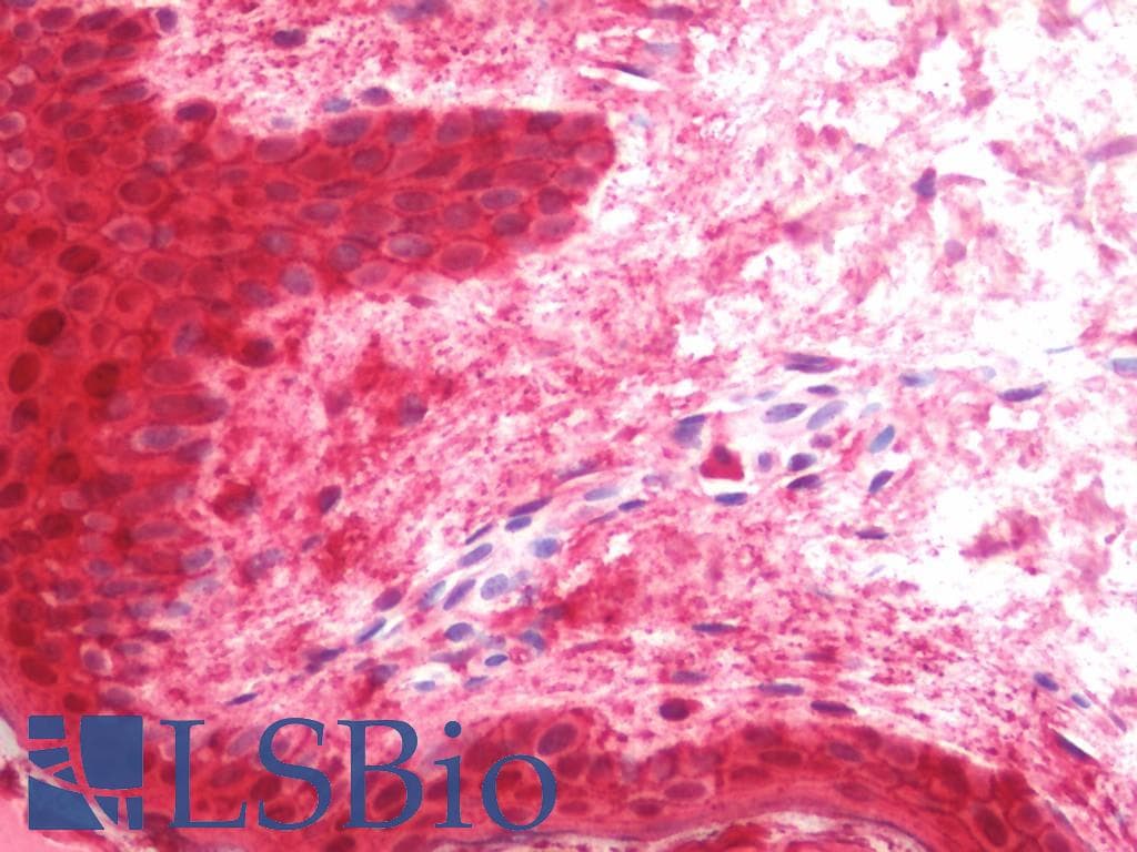 LGALS7 / Galectin 7 Antibody (FITC)