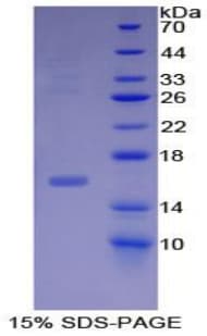 Human INHBB / Inhibin Beta B Protein (Recombinant His)